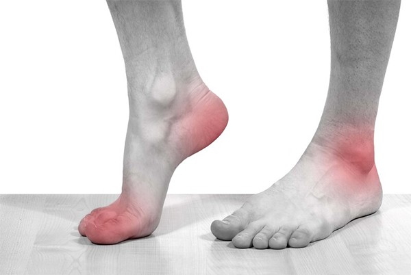 Triệu chứng của bệnh viêm gân gót chân