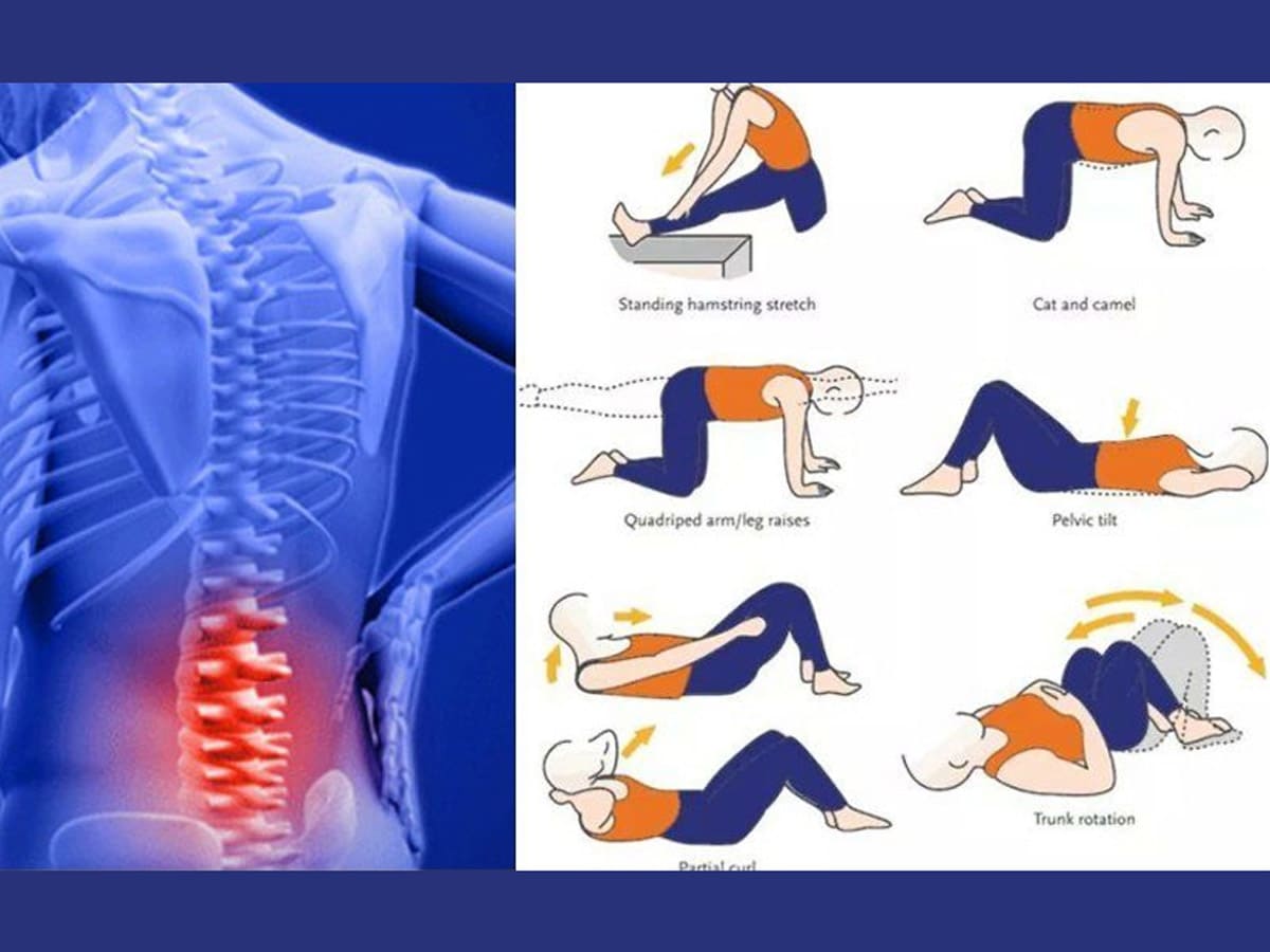 [TOP] 9+ Bài tập thể dục chữa đau lưng tại nhà hiệu quả