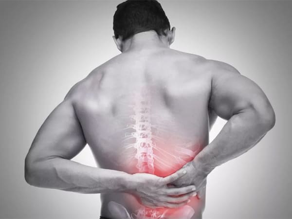 Nguyên nhân gây ra tình trạng đau lưng