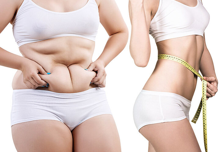 Tình trạng béo bụng xảy ra ở nhiều người
