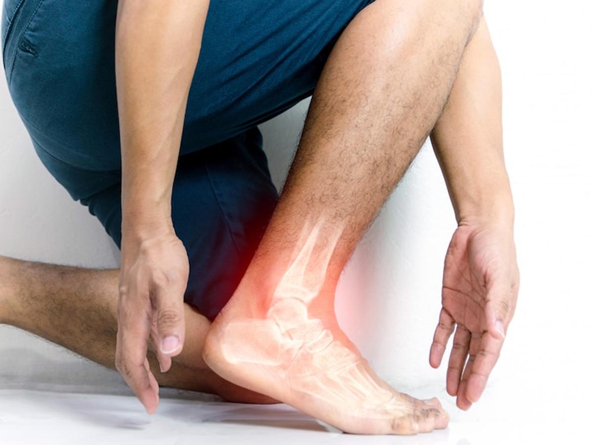 [Bật mí] Nguyên nhân đau nhức mu bàn chân & Cách điều trị