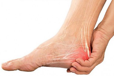 7+ Cách điều trị viêm gân gót chân tại nhà an toàn, dễ thực hiện